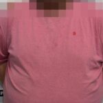 Motociclista fica ferido em colisão entre carro e moto em Lontras